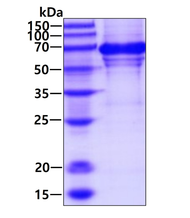3 μg by SDS-PAGE under reducing condition and visualized by coomassie blue stain